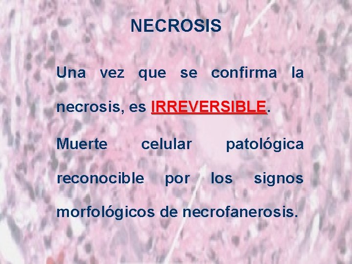 NECROSIS Una vez que se confirma la necrosis, es IRREVERSIBLE Muerte celular reconocible por