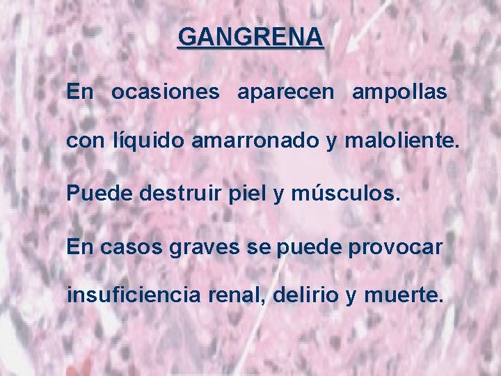 GANGRENA En ocasiones aparecen ampollas con líquido amarronado y maloliente. Puede destruir piel y