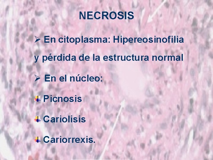 NECROSIS Ø En citoplasma: Hipereosinofilia y pérdida de la estructura normal Ø En el