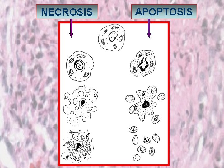 NECROSIS APOPTOSIS 