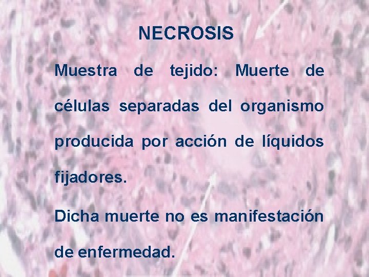 NECROSIS Muestra de tejido: Muerte de células separadas del organismo producida por acción de