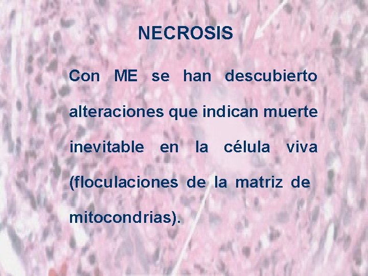 NECROSIS Con ME se han descubierto alteraciones que indican muerte inevitable en la célula