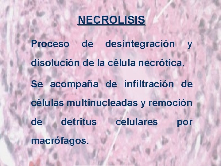 NECROLISIS Proceso de desintegración y disolución de la célula necrótica. Se acompaña de infiltración