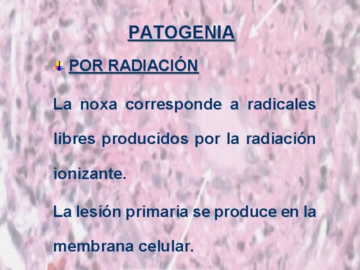 PATOGENIA POR RADIACIÓN La noxa corresponde a radicales libres producidos por la radiación ionizante.