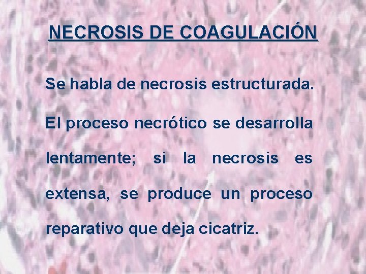 NECROSIS DE COAGULACIÓN Se habla de necrosis estructurada. El proceso necrótico se desarrolla lentamente;