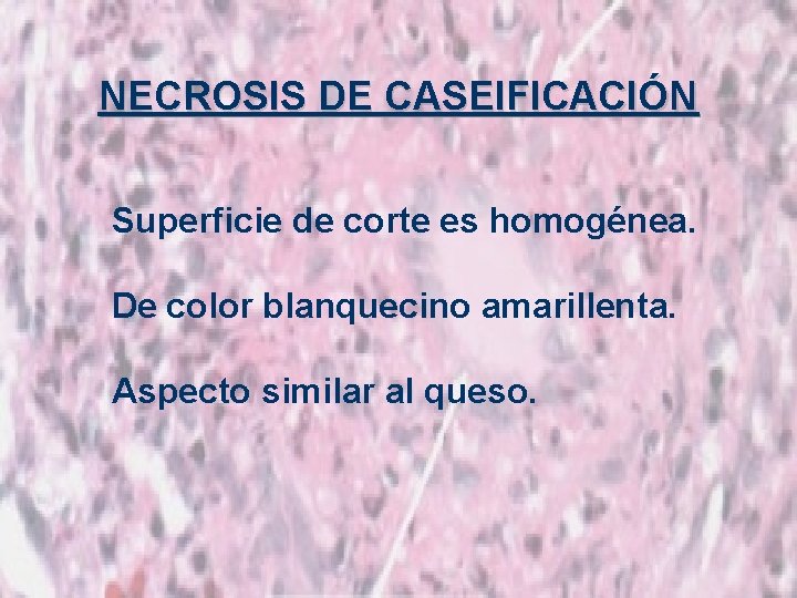 NECROSIS DE CASEIFICACIÓN Superficie de corte es homogénea. De color blanquecino amarillenta. Aspecto similar