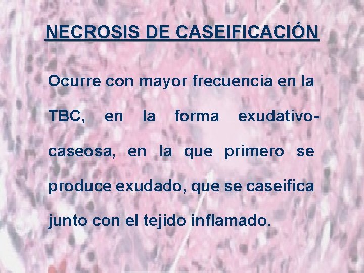 NECROSIS DE CASEIFICACIÓN Ocurre con mayor frecuencia en la TBC, en la forma exudativo-