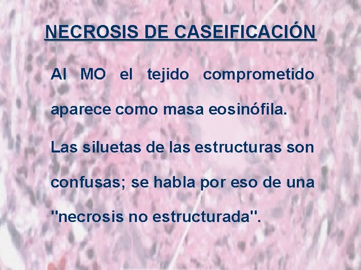NECROSIS DE CASEIFICACIÓN Al MO el tejido comprometido aparece como masa eosinófila. Las siluetas
