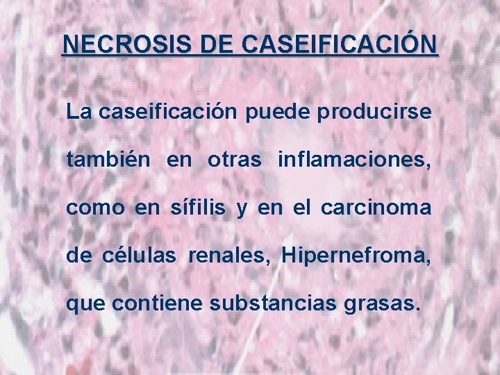 NECROSIS DE CASEIFICACIÓN La caseificación puede producirse también en otras inflamaciones, como en sífilis