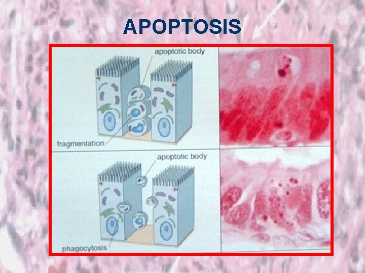 APOPTOSIS 