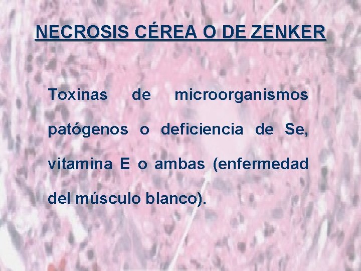 NECROSIS CÉREA O DE ZENKER Toxinas de microorganismos patógenos o deficiencia de Se, vitamina