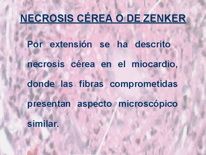 NECROSIS CÉREA O DE ZENKER Por extensión se ha descrito necrosis cérea en el