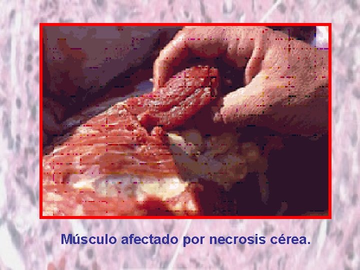 Músculo afectado por necrosis cérea. 