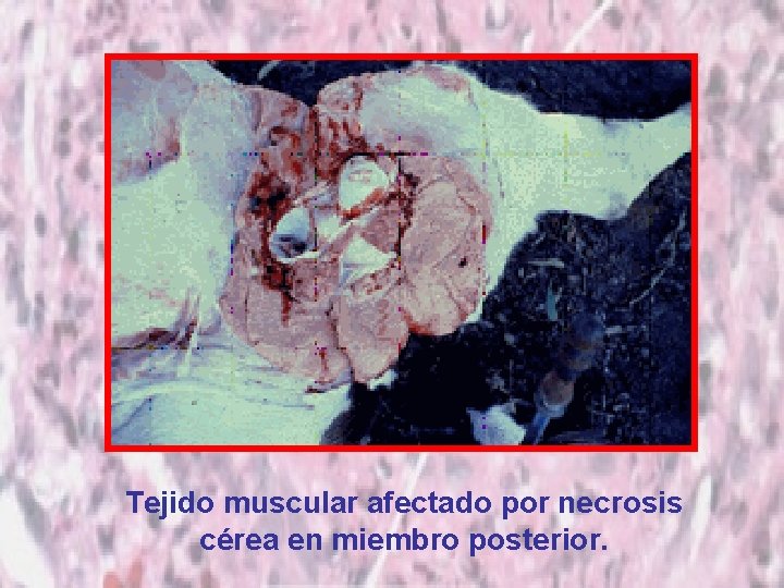 Tejido muscular afectado por necrosis cérea en miembro posterior. 