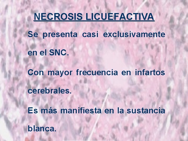 NECROSIS LICUEFACTIVA Se presenta casi exclusivamente en el SNC. Con mayor frecuencia en infartos
