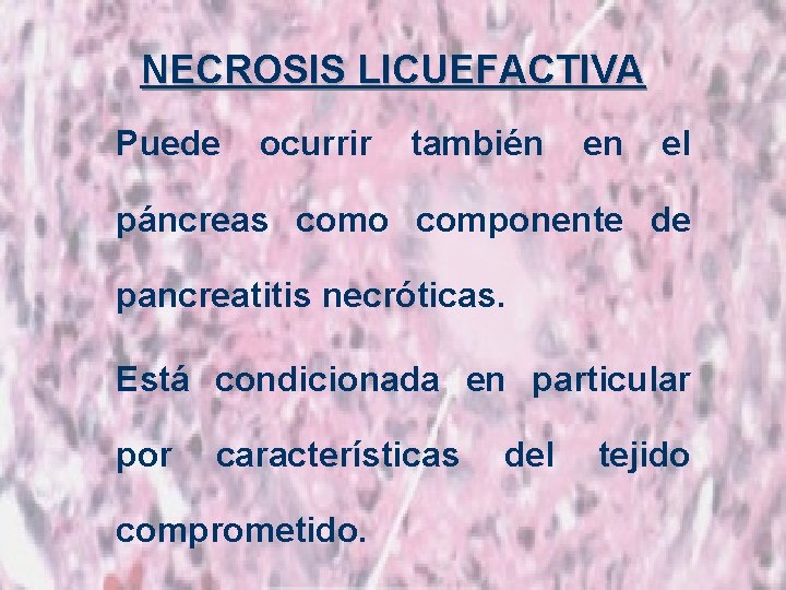 NECROSIS LICUEFACTIVA Puede ocurrir también en el páncreas como componente de pancreatitis necróticas. Está
