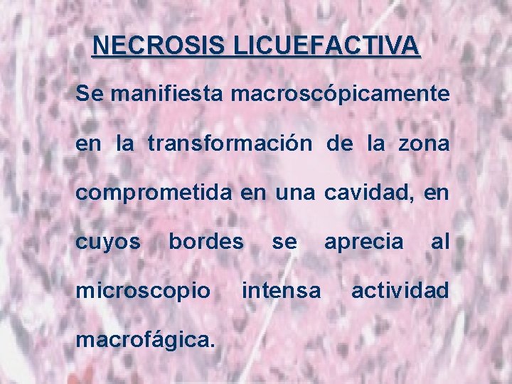 NECROSIS LICUEFACTIVA Se manifiesta macroscópicamente en la transformación de la zona comprometida en una