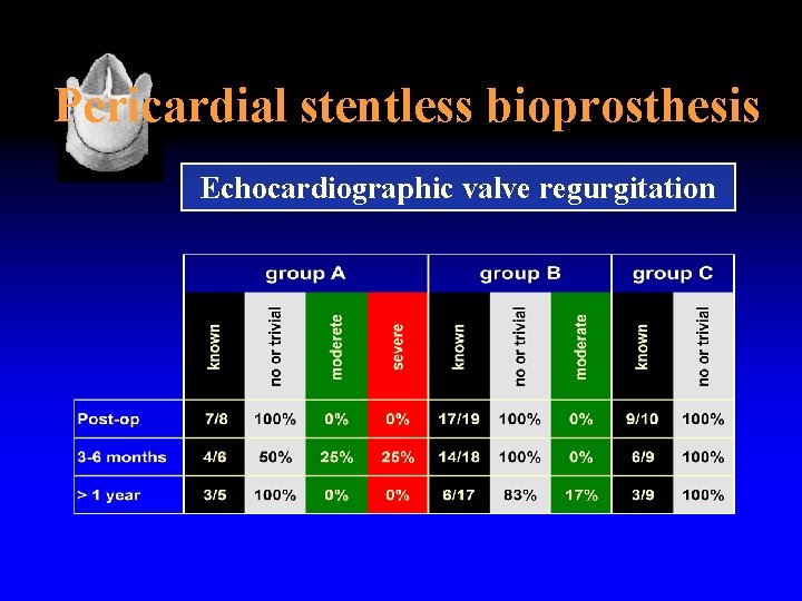 Pericardial stentless bioprosthesis Echocardiographic valve regurgitation 