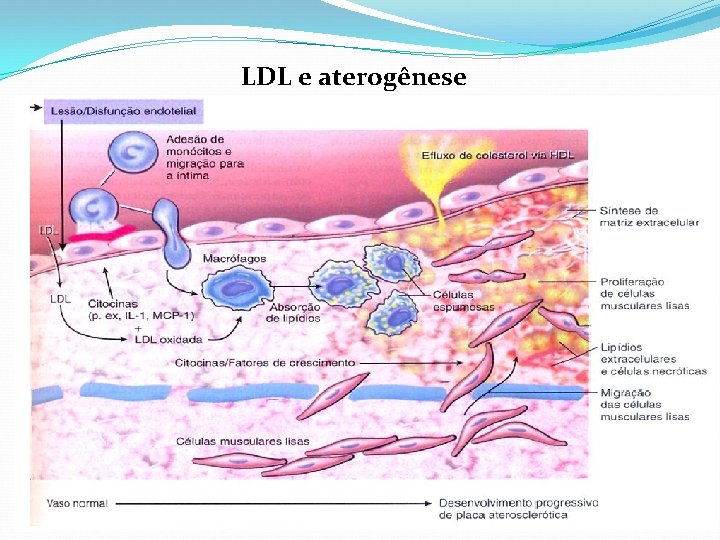 LDL e aterogênese 
