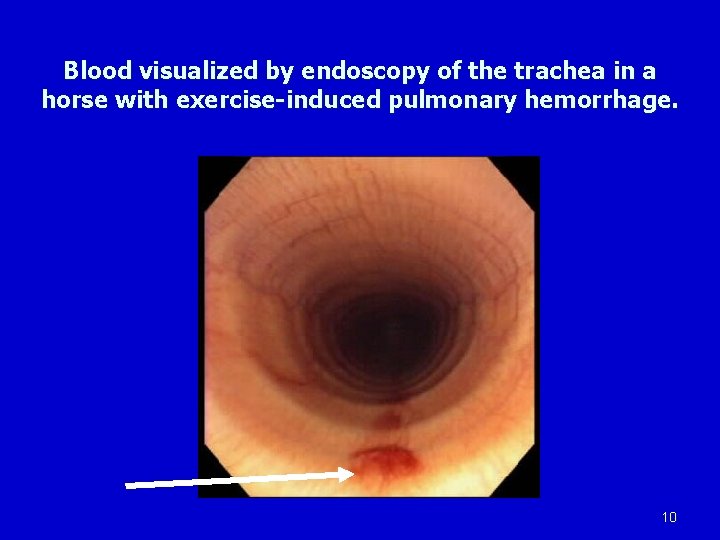 Blood visualized by endoscopy of the trachea in a horse with exercise-induced pulmonary hemorrhage.