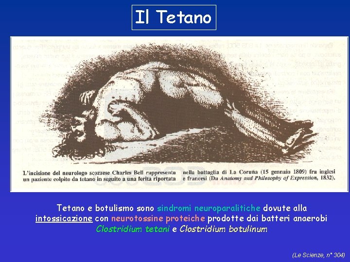 Il Tetano e botulismo sono sindromi neuroparalitiche dovute alla intossicazione con neurotossine proteiche prodotte