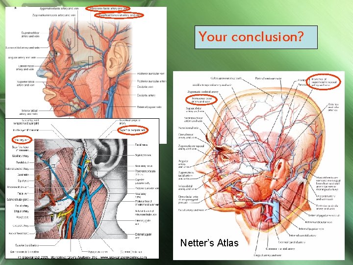 Your conclusion? Netter’s Atlas 103 