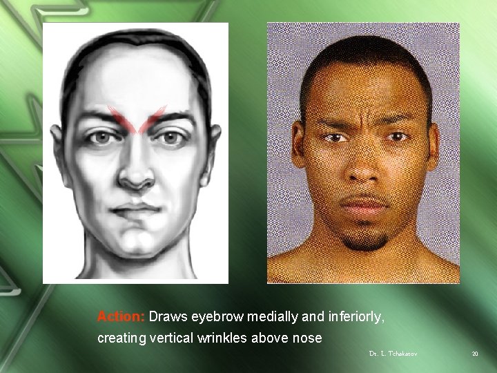 Action: Draws eyebrow medially and inferiorly, creating vertical wrinkles above nose Dr. L. Tchakarov