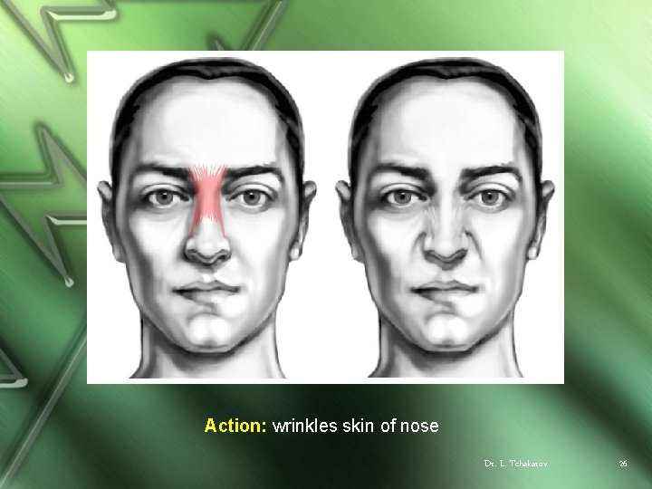 Action: wrinkles skin of nose Dr. L. Tchakarov 26 