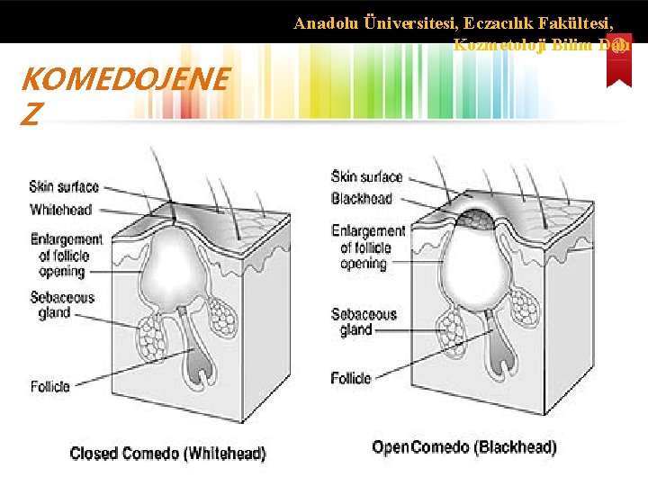 Anadolu Üniversitesi, Eczacılık Fakültesi, Kozmetoloji Bilim Dalı KOMEDOJENE Z 
