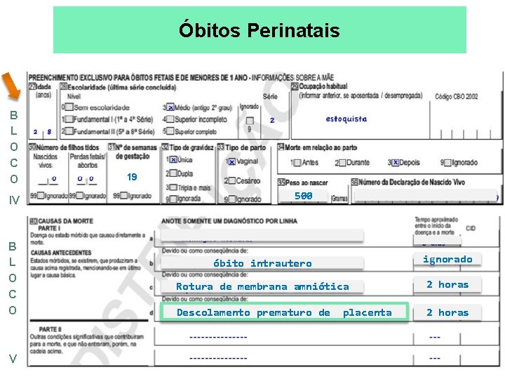 Óbitos Perinatais B L O C O IV B L O C O V