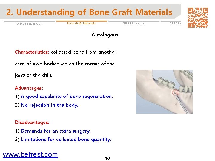 2. Understanding of Bone Graft Materials Knowledge of GBR Membrane Bone Graft Materials Autologous