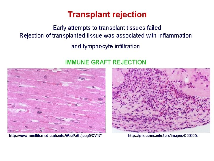 Transplant rejection Early attempts to transplant tissues failed Rejection of transplanted tissue was associated
