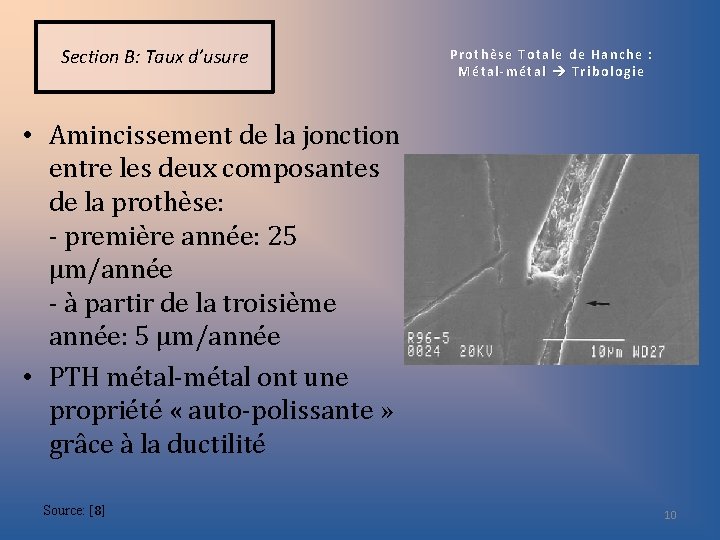 Section B: Taux d’usure Prothèse Totale de Hanche : Métal-métal Tribologie • Amincissement de
