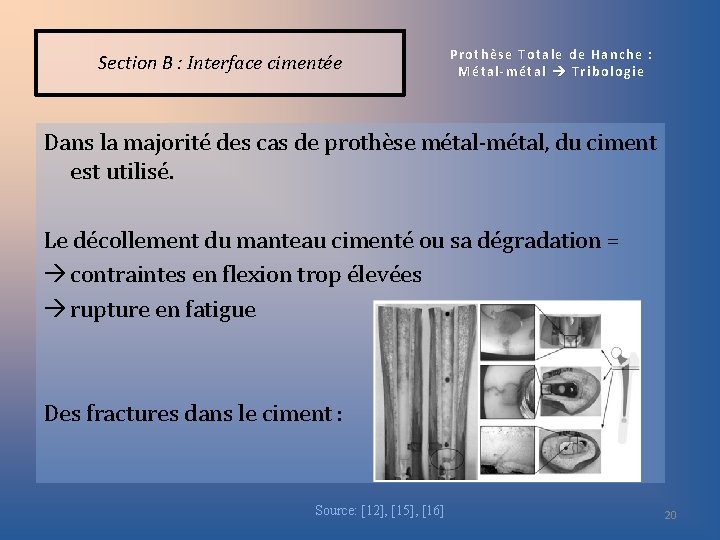 Section B : Interface cimentée Prothèse Totale de Hanche : Métal-métal Tribologie Dans la