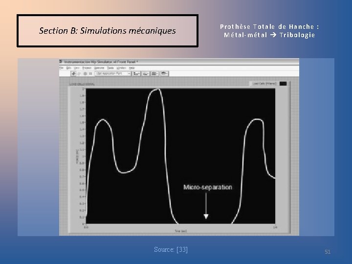Section B: Simulations mécaniques Source: [33] Prothèse Totale de Hanche : Métal-métal Tribologie 51