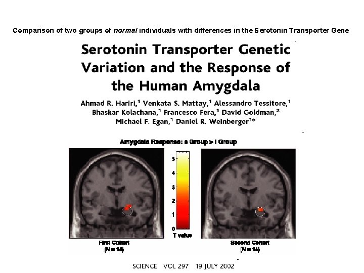 Comparison of two groups of normal individuals with differences in the Serotonin Transporter Gene