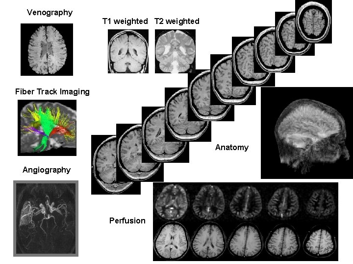 Venography T 1 weighted T 2 weighted Fiber Track Imaging Anatomy Angiography Perfusion 