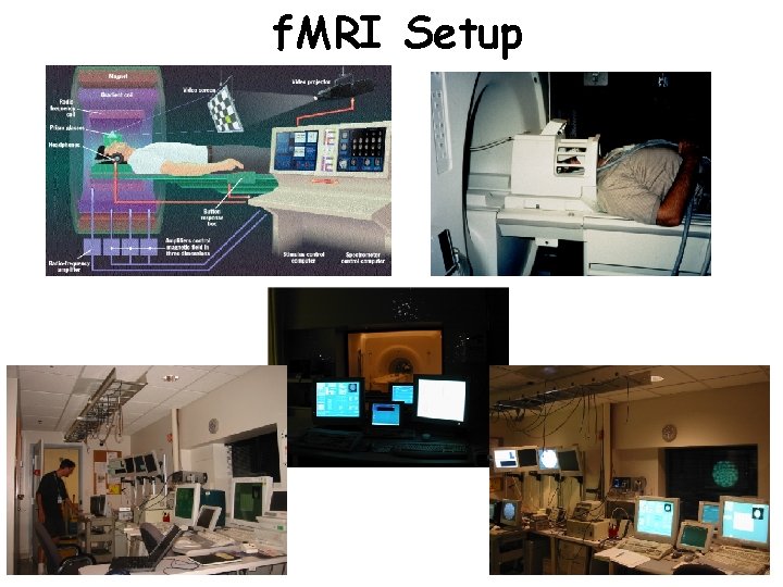f. MRI Setup 