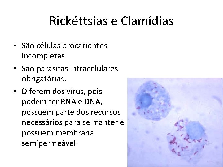 Rickéttsias e Clamídias • São células procariontes incompletas. • São parasitas intracelulares obrigatórias. •