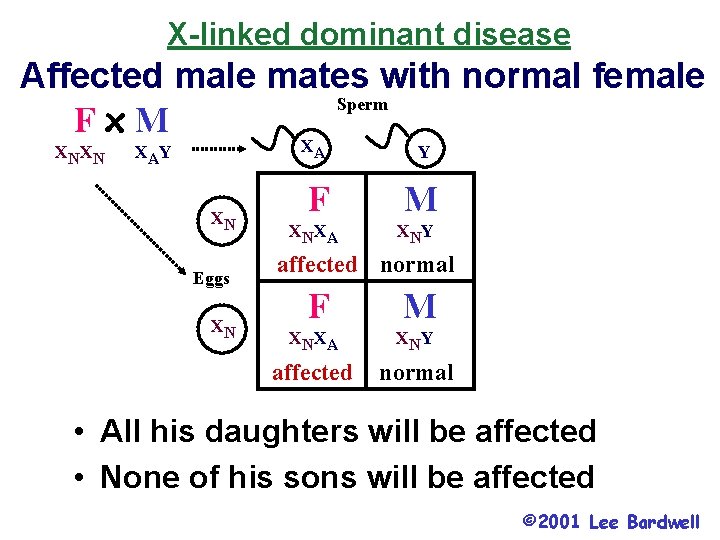 X-linked dominant disease Affected male mates with normal female Sperm Fx. M XNXN XAY