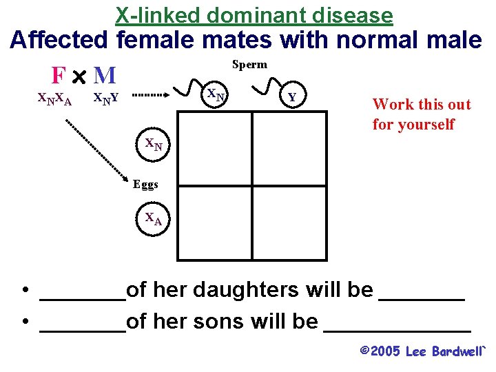 X-linked dominant disease Affected female mates with normal male Sperm Fx. M XNXA XN