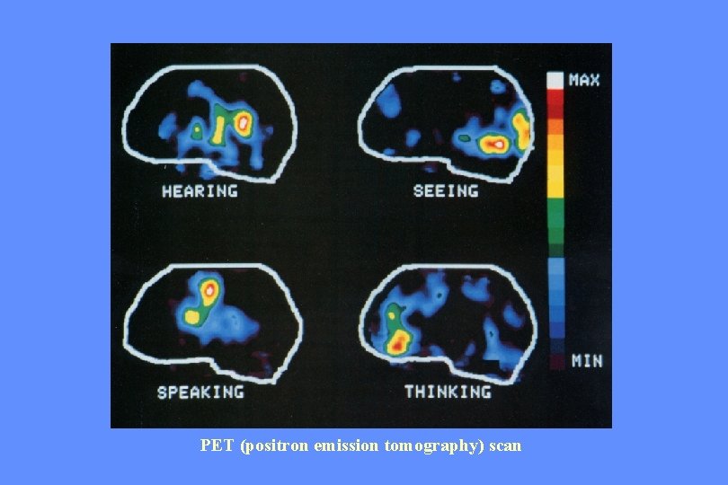 PET (positron emission tomography) scan 