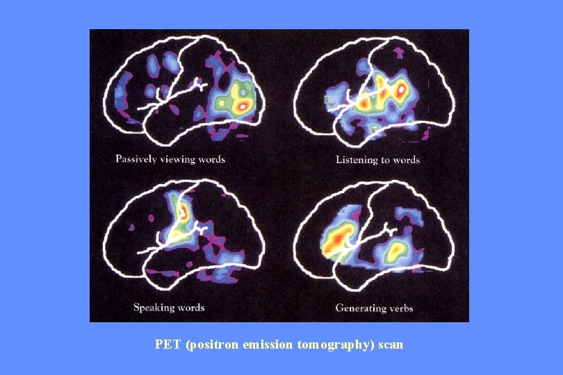 PET (positron emission tomography) scan 
