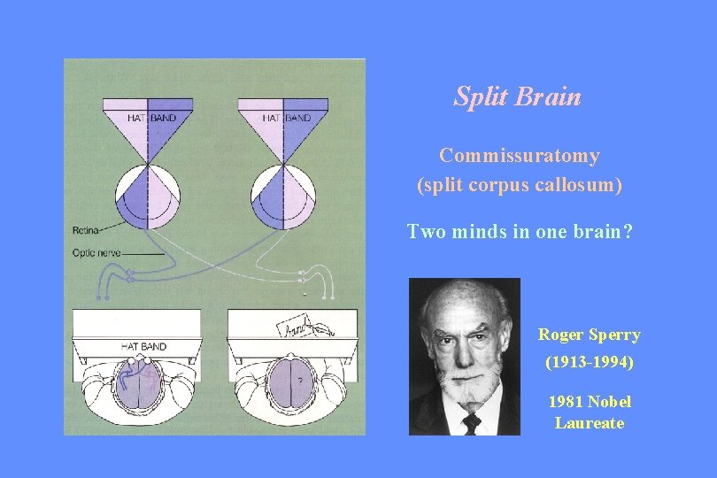 Split Brain Commissuratomy (split corpus callosum) Two minds in one brain? Roger Sperry (1913