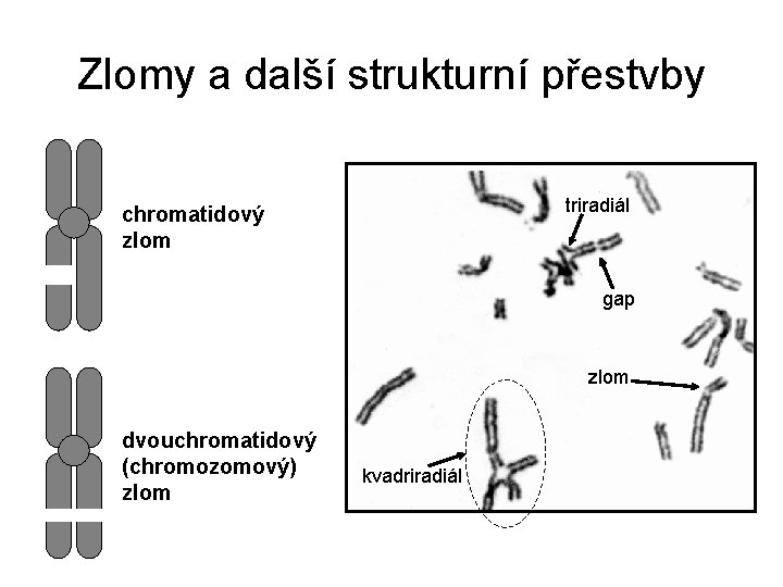 Zlomy a další strukturní přestvby triradiál chromatidový zlom gap zlom dvouchromatidový (chromozomový) zlom kvadriradiál
