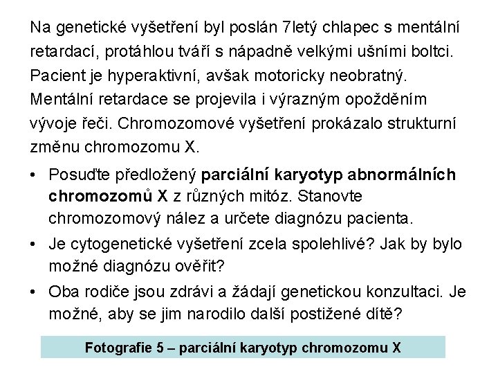 Na genetické vyšetření byl poslán 7 letý chlapec s mentální retardací, protáhlou tváří s