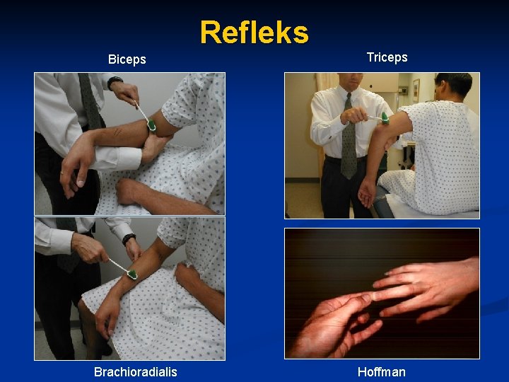Refleks Biceps Brachioradialis Triceps Hoffman 