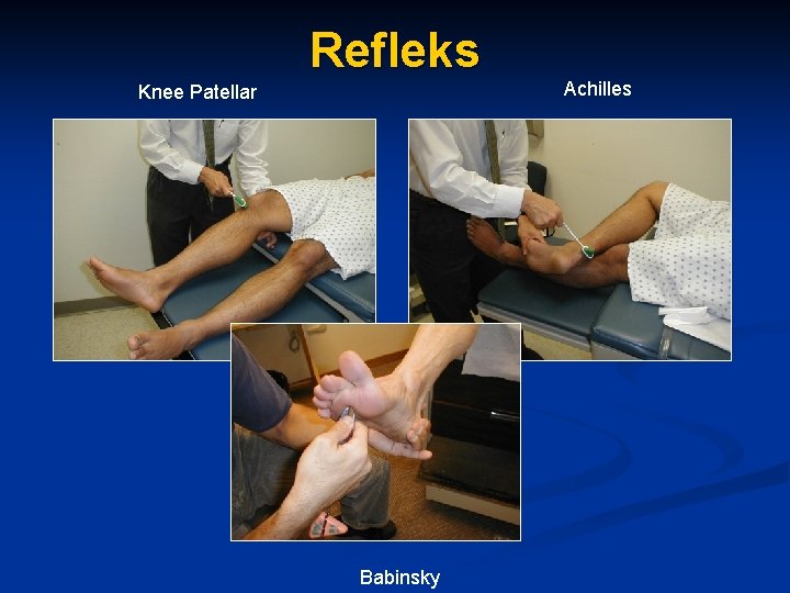 Refleks Knee Patellar Babinsky Achilles 