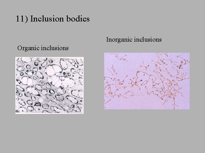 11) Inclusion bodies Inorganic inclusions Organic inclusions 11) Inclusion bodies Inorganic inclusions Organic inclusions
