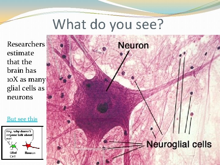 What do you see? Researchers estimate that the brain has 10 X as many What do you see? Researchers estimate that the brain has 10 X as many